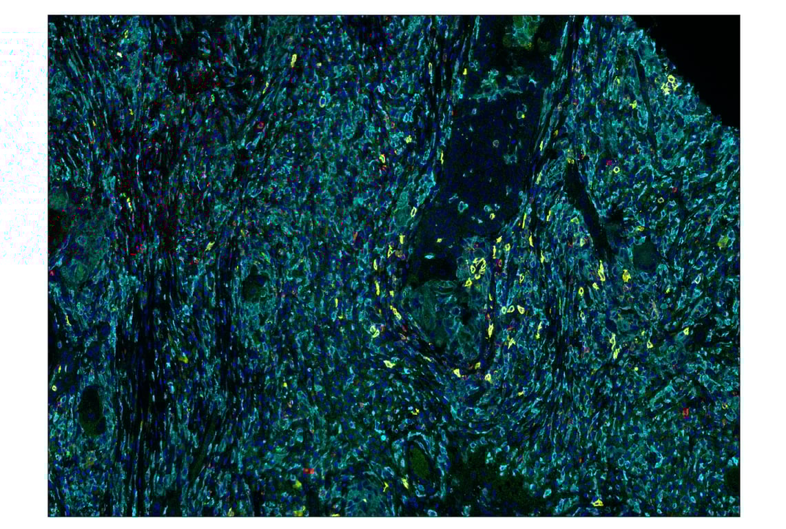 Immunohistochemistry Image 1: CD20 (E7B7T) & CO-0011-488 SignalStar<sup>™</sup> Oligo-Antibody Pair