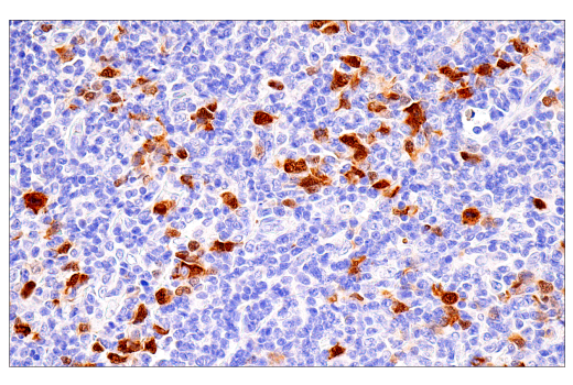 Immunohistochemistry Image 8: Cyclin A2 (E6D1J) XP<sup>®</sup> Rabbit mAb (BSA and Azide Free)