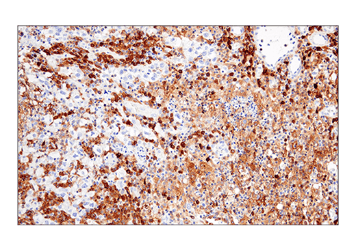 Immunohistochemistry Image 1: CRACC/SLAMF7/CD319 (E5C4M) Rabbit Monoclonal Antibody
