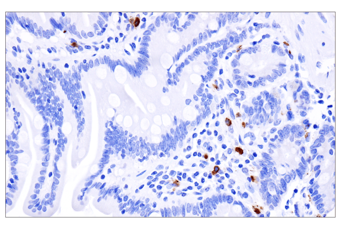 Immunohistochemistry Image 8: Mast Cell Chymase/CMA1 (F6S4Q) Rabbit Monoclonal Antibody