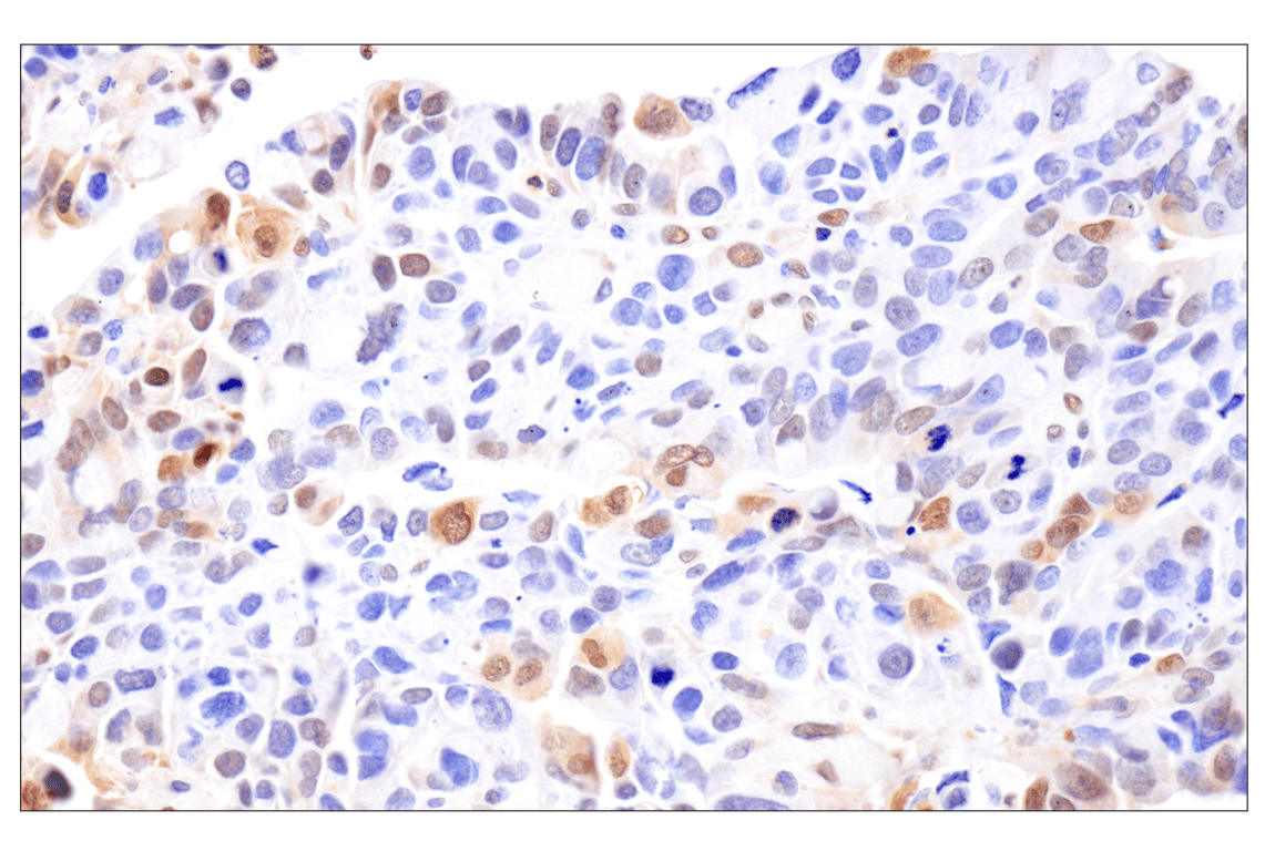 Immunohistochemistry Image 4: Phospho-Stat3 (Ser727) (D4X3C) Rabbit Monoclonal Antibody (BSA and Azide Free)