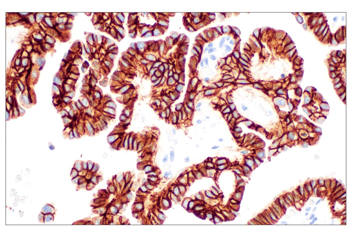 Immunohistochemistry Image 2: TACSTD2/TROP2 (F4W4J) Rabbit Monoclonal Antibody