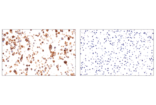 Immunohistochemistry Image 1: OX40 (ACT35) Mouse Monoclonal Antibody