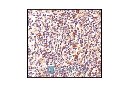 undefined Image 34: HSP/Chaperone Antibody Sampler Kit