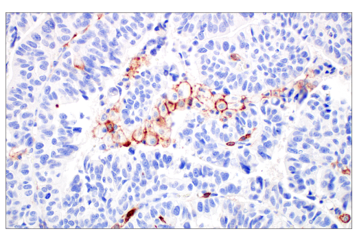Immunohistochemistry Image 1: Fc-gammaRIIB (E4D2F) Rabbit Monoclonal Antibody (BSA and Azide Free)