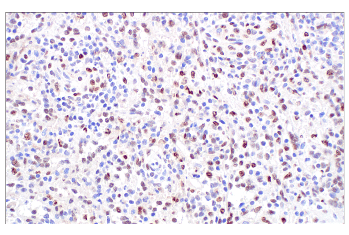 Immunohistochemistry Image 7: TFE3 (F3Z2Q) Rabbit Monoclonal Antibody