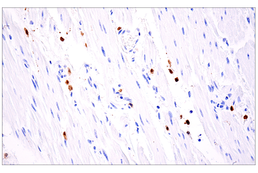 Immunohistochemistry Image 3: Calretinin (E7R6O) Rabbit Monoclonal Antibody