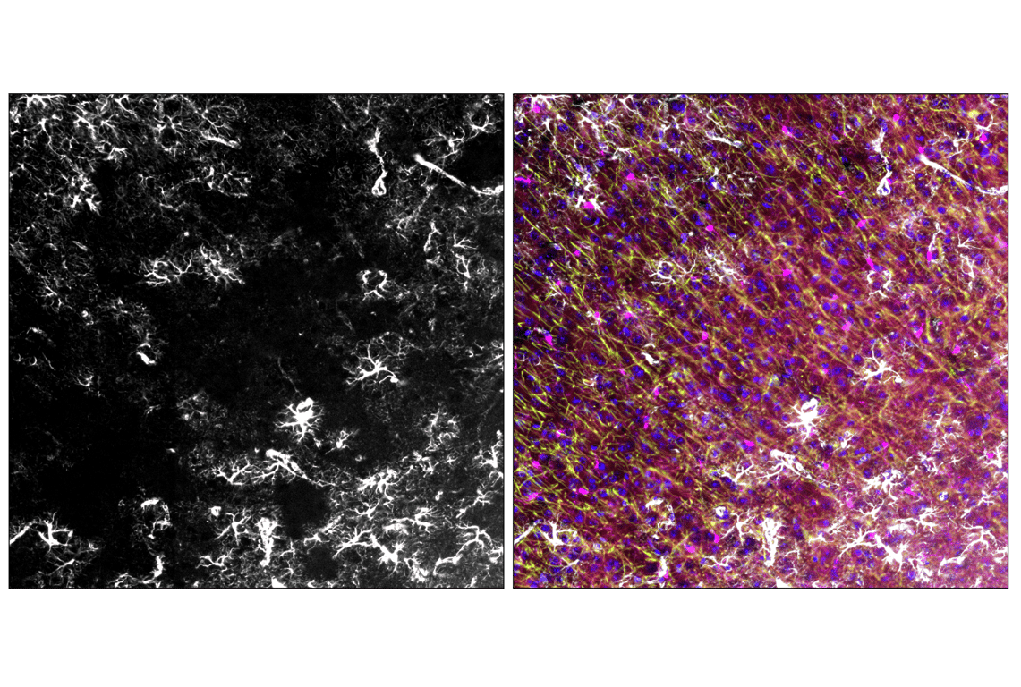 Immunofluorescence Image 3: GFAP (E4L7M) Rabbit Monoclonal Antibody (Alexa Fluor<sup>®</sup> 488 Conjugate)