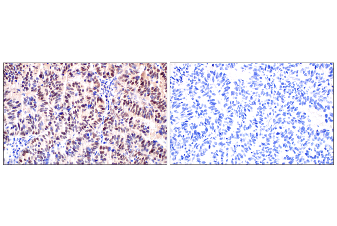 Immunohistochemistry Image 8: ID1 (F2M1J) Rabbit Monoclonal Antibody (BSA and Azide Free)
