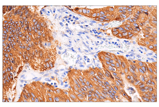 Immunohistochemistry Image 4: HER2/ErbB2 (CB11) Mouse Monoclonal Antibody