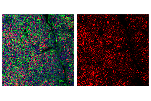 Immunofluorescence Image 3: Tox/Tox2 (E6G5O) Rabbit Monoclonal Antibody (Alexa Fluor<sup>®</sup> 647 Conjugate)