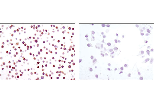 Immunohistochemistry Image 4: NFAT1 (D43B1) Rabbit Monoclonal Antibody (BSA and Azide Free)
