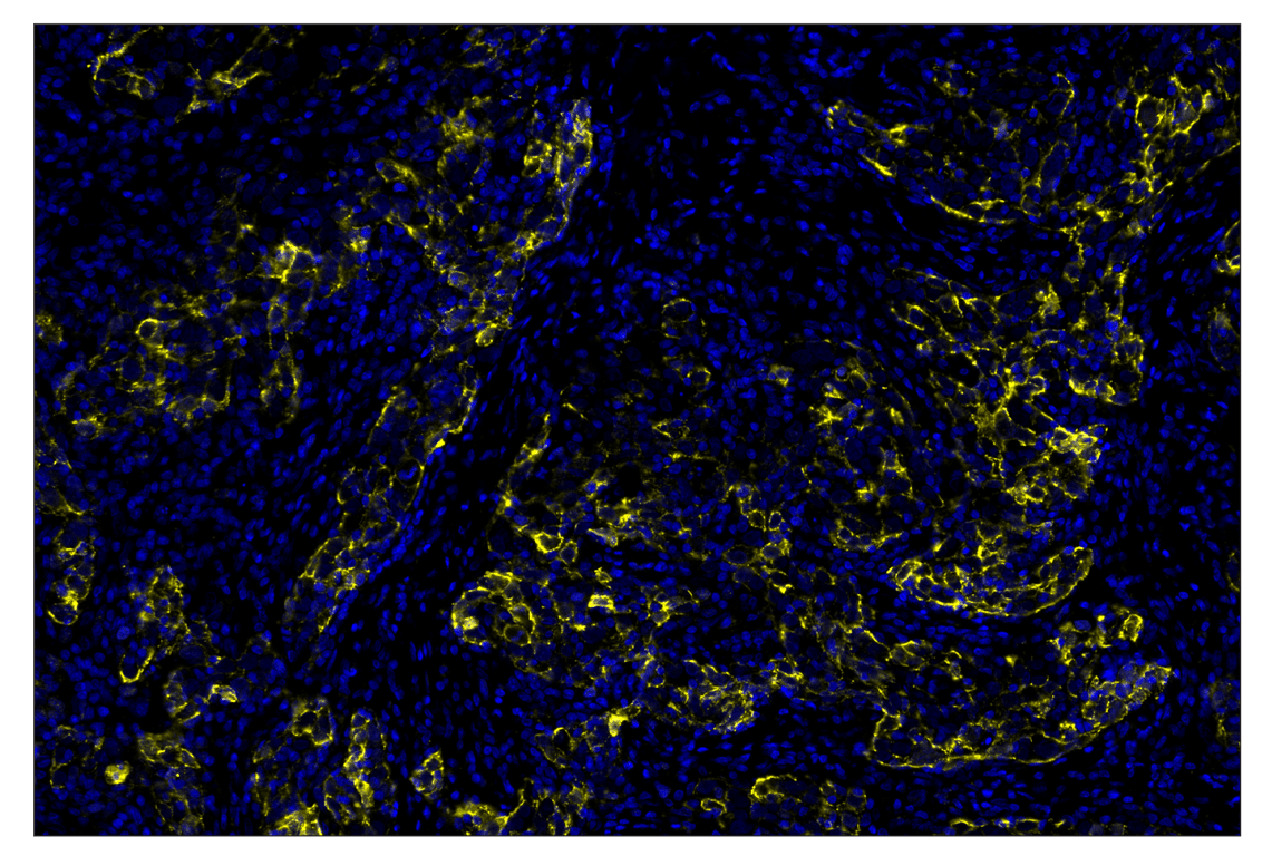Immunohistochemistry Image 2: Cleaved Caspase-3 (Asp175) (D3E9) & CO-0118-594 SignalStar<sup>™</sup> Oligo-Antibody Pair