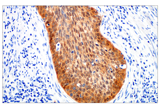Immunohistochemistry Image 1: p16 INK4A (BC42) Mouse Monoclonal Antibody