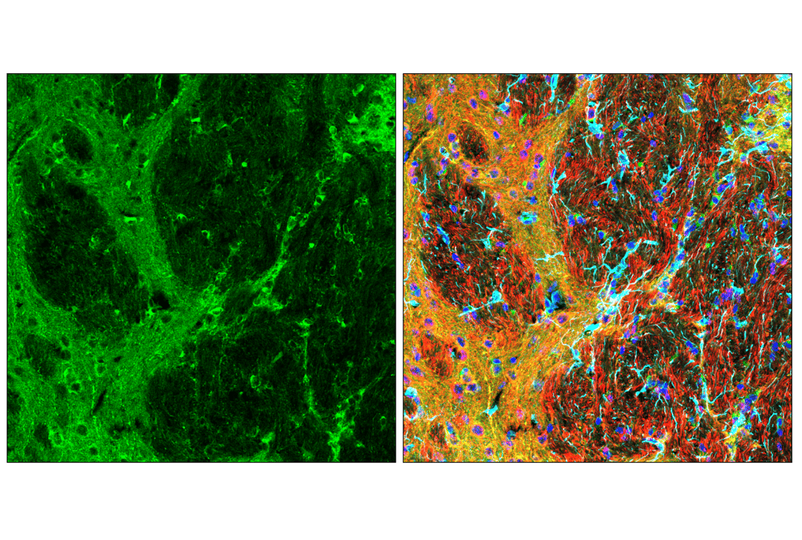 Immunofluorescence Image 3: Phospho-Tau (Thr205) (E9A7P) Mouse Monoclonal Antibody (BSA and Azide Free)