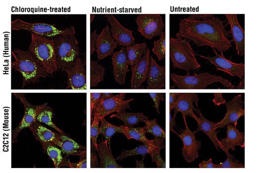undefined Image 2: Chloroquine