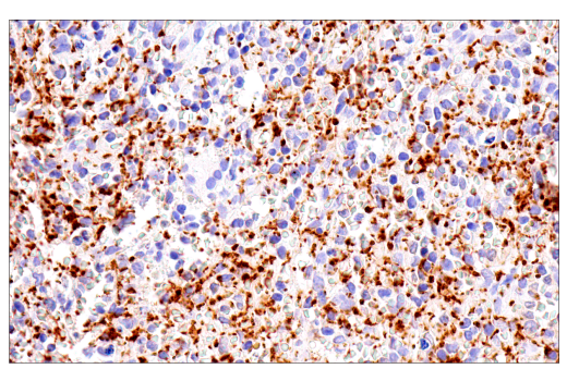 Immunohistochemistry Image 5: Rab27B (E4V3O) Rabbit Monoclonal Antibody