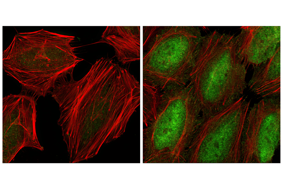 Immunofluorescence Image 1: Phospho-NF-kappaB p65 (Ser536) (93H1) Rabbit Monoclonal Antibody