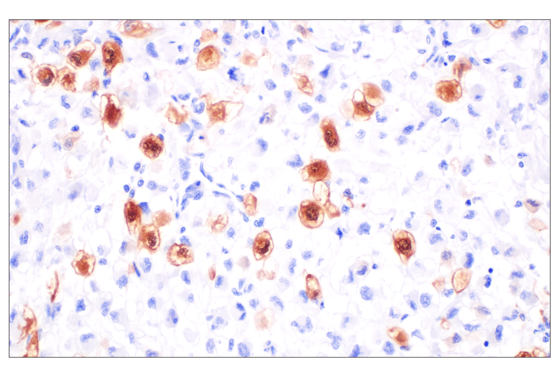 Immunohistochemistry Image 6: Thymidine Kinase 1 (E2H7Z) Rabbit Monoclonal Antibody