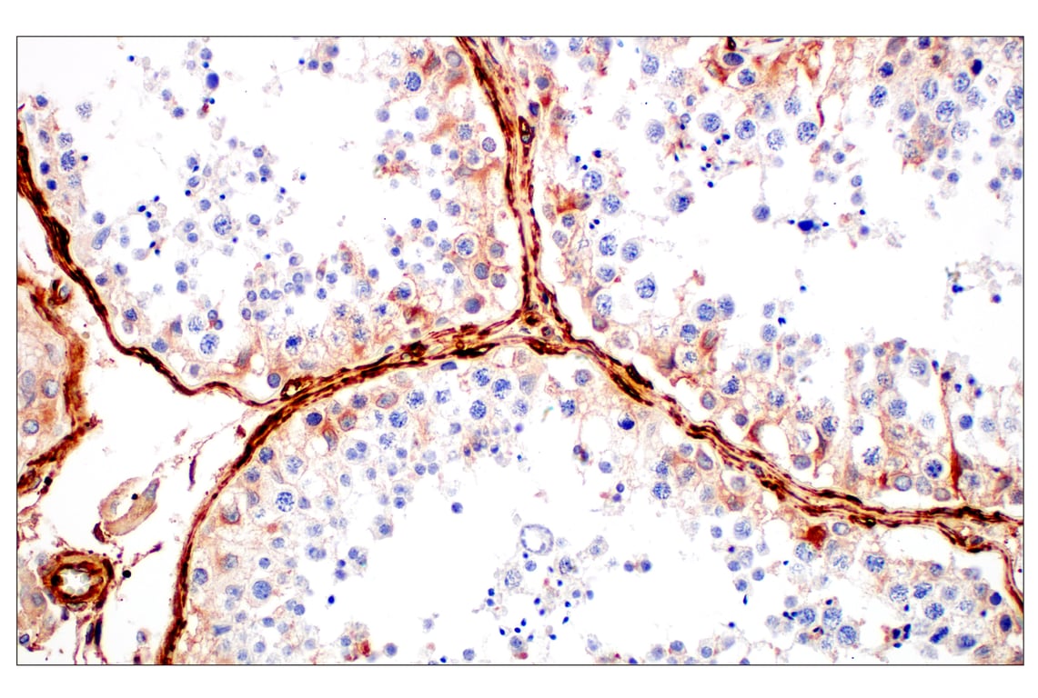 Immunohistochemistry Image 9: Filamin A (E8P8M) Rabbit Monoclonal Antibody