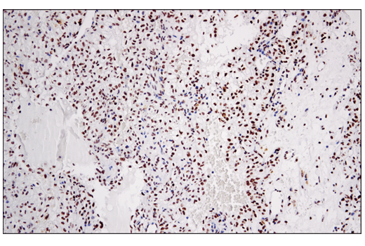 undefined Image 8: PhosphoPlus<sup>®</sup> DNA-PKcs (Ser2056) Antibody Duet