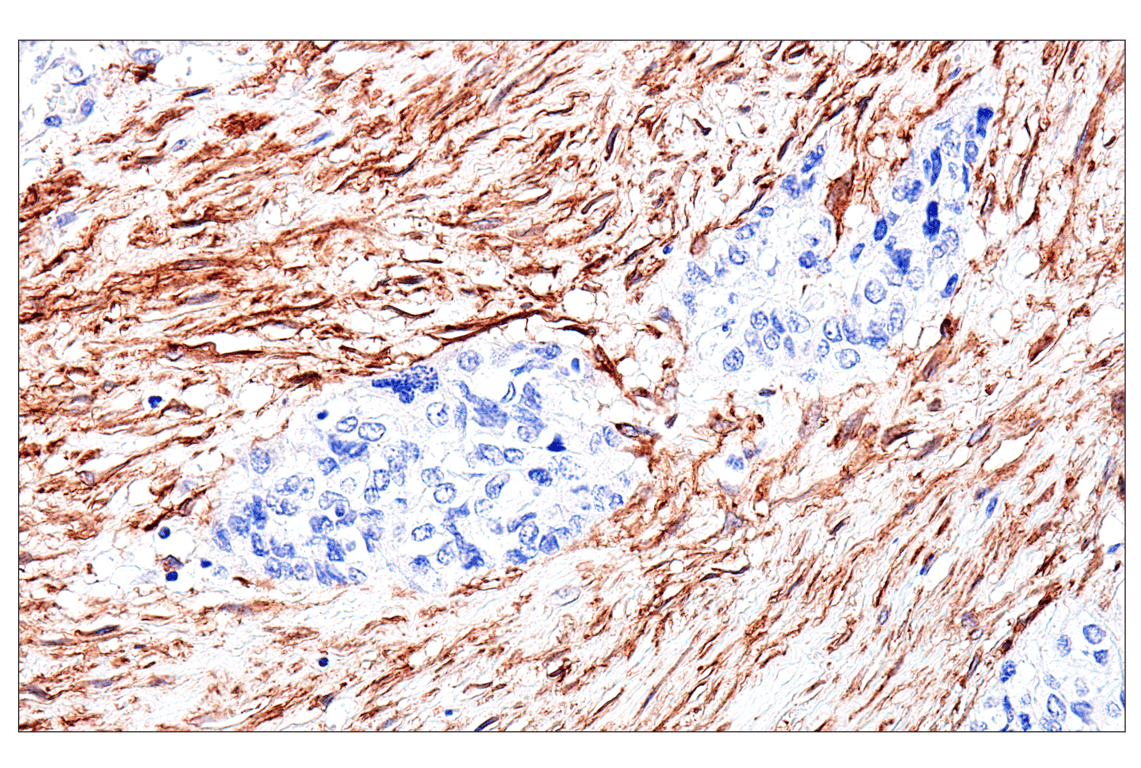 Immunohistochemistry Image 9: FAP (F1A4G) Rabbit Monoclonal Antibody