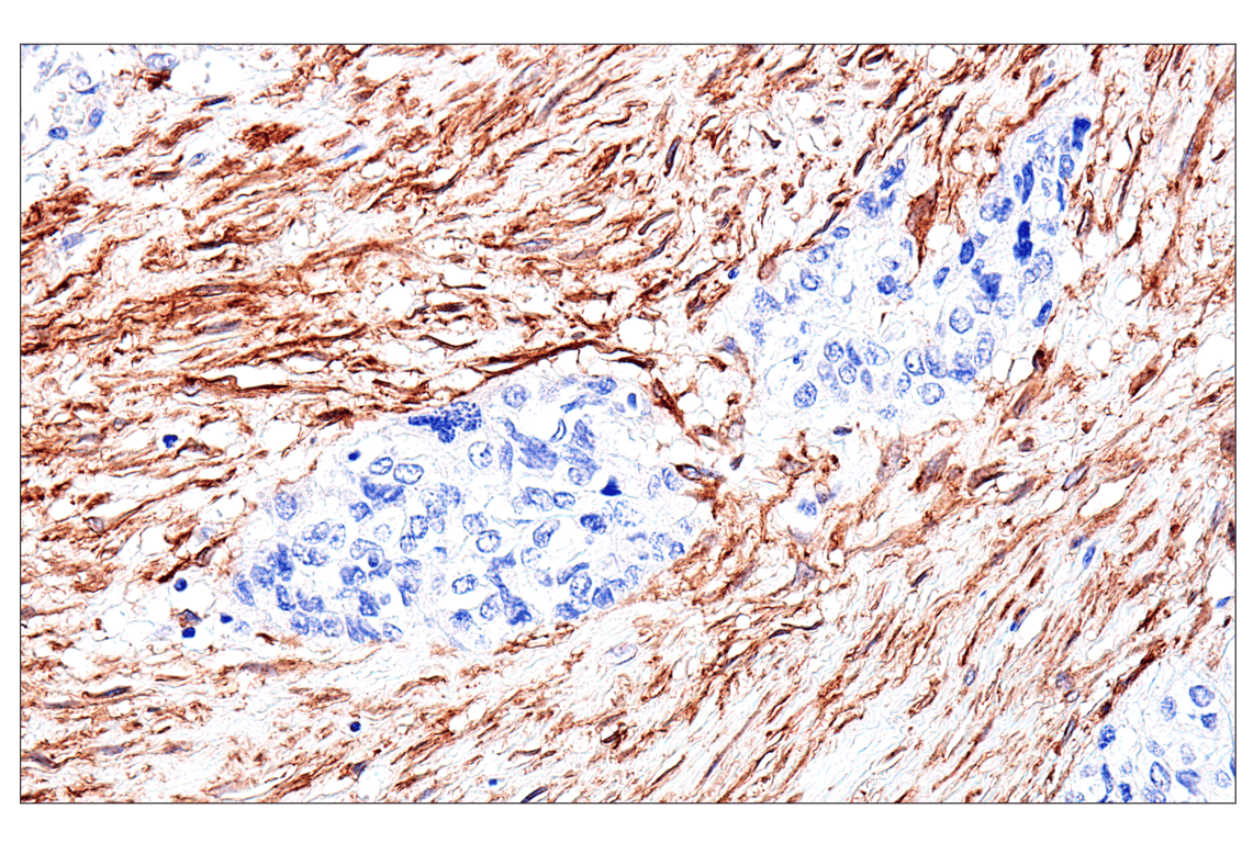 Immunohistochemistry Image 9: FAP (F1A4G) Rabbit mAb