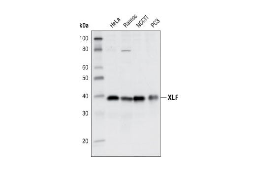 undefined Image 4: Double Strand Breaks (DSB) Repair Antibody Sampler Kit