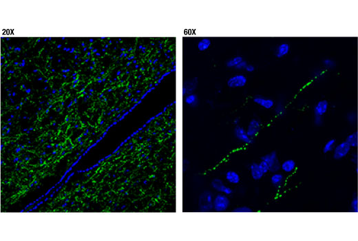 Immunofluorescence Image 1: POMC (D3R1U) Rabbit Monoclonal Antibody
