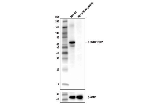 Western Blotting Image 1: SQSTM1/p62 (D6M5X) Rabbit mAb