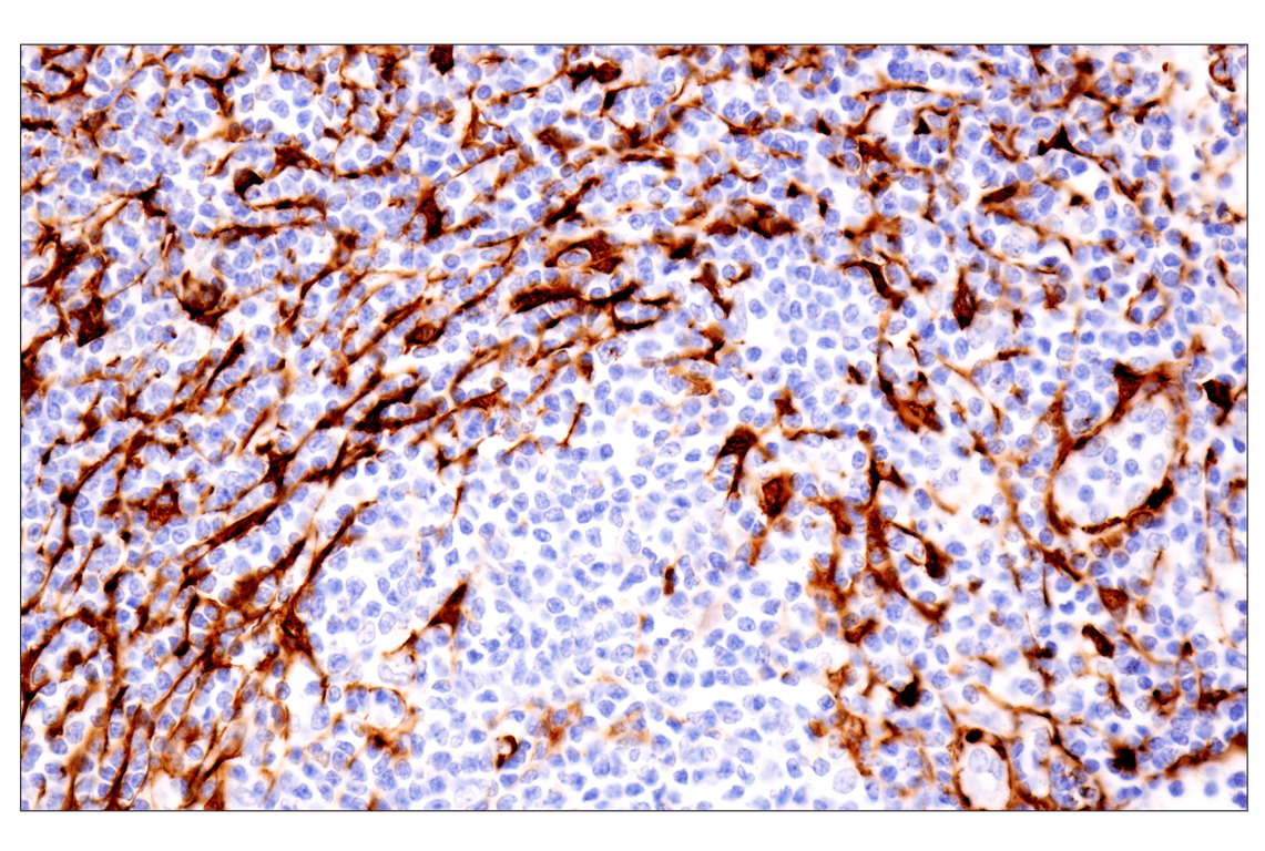 Immunohistochemistry Image 8: Transgelin/TAGLN (F3B7H) Rabbit Monoclonal Antibody