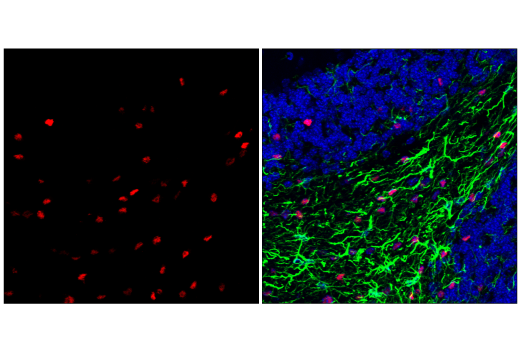 Immunofluorescence Image 2: Olig2 (E6G6Q) Rabbit Monoclonal Antibody (BSA and Azide Free)
