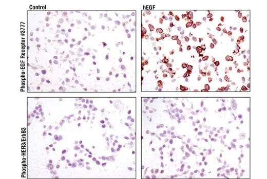 Immunohistochemistry Image 1: Phospho-HER3/ErbB3 (Tyr1289) (D1B5) Rabbit Monoclonal Antibody (BSA and Azide Free)