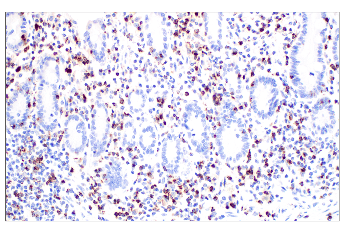 Immunohistochemistry Image 7: NKG7 (F4V5I) Rabbit Monoclonal Antibody