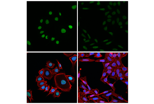 undefined Image 18: Jak/Stat Pathway Inhibitors Antibody Sampler Kit