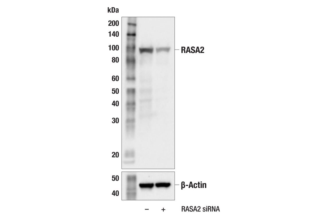 Western Blotting Image 2: RASA2 (F2O1I) Rabbit Monoclonal Antibody
