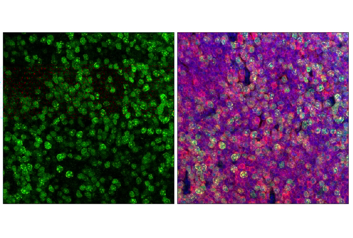Immunofluorescence Image 1: Ubiquityl-Histone H3 (Lys18) (E4D7R) Rabbit Monoclonal Antibody