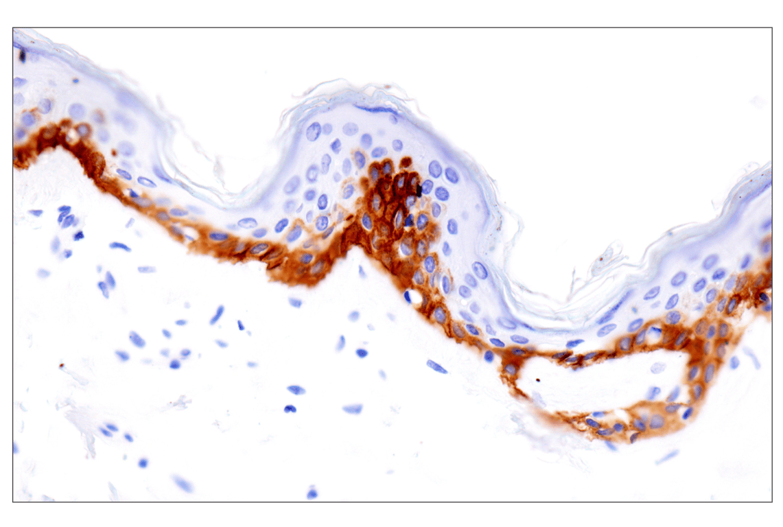 Immunohistochemistry Image 7: COL17A1 (F5U1Z) Rabbit Monoclonal Antibody