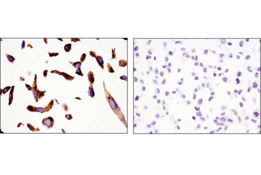Immunohistochemistry Image 2: Napsin A (D5P6G) Rabbit Monoclonal Antibody