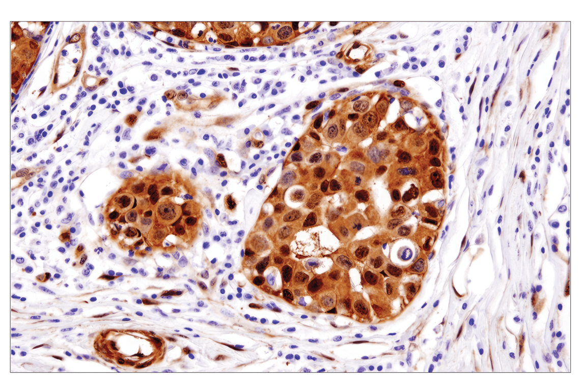 Immunohistochemistry Image 1: YAP (D8H1X) XP<sup>®</sup> Rabbit mAb