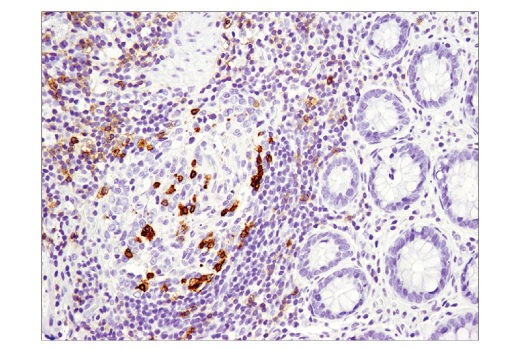 Immunohistochemistry Image 1: PD-1 (Intracellular Domain) (D4W2J) XP<sup>®</sup> Rabbit mAb (BSA and Azide Free)