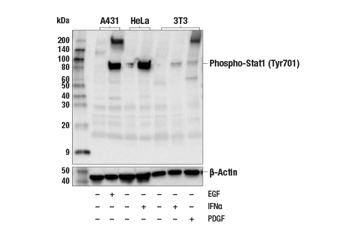 Western Blotting Image 2: Phospho-Stat1 (Tyr701) (58D6) Rabbit Monoclonal Antibody (Biotinylated)