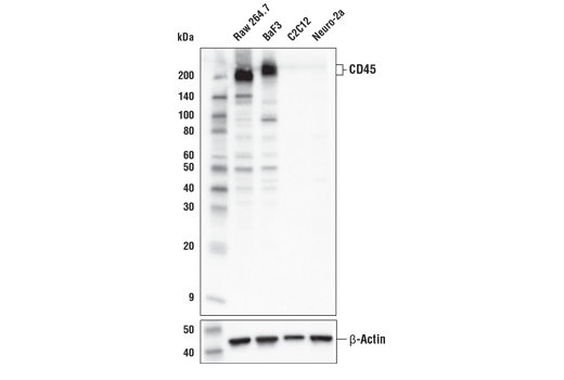 Western Blotting Image 1: CD45 (D4H7K) Rabbit mAb