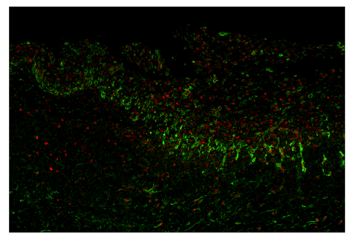 Immunohistochemistry Image 8: NT5E/CD73 (D7F9A) & CO-0039-594 SignalStar<sup>™</sup> Oligo-Antibody Pair