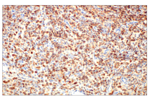 Immunohistochemistry Image 3: CD45 (Intracellular Domain) (D9M8I) Rabbit Monoclonal Antibody (BSA and Azide Free)