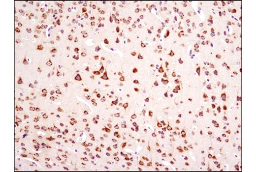 Immunohistochemistry Image 2: RCAS1 (D6P5J) Rabbit Monoclonal Antibody