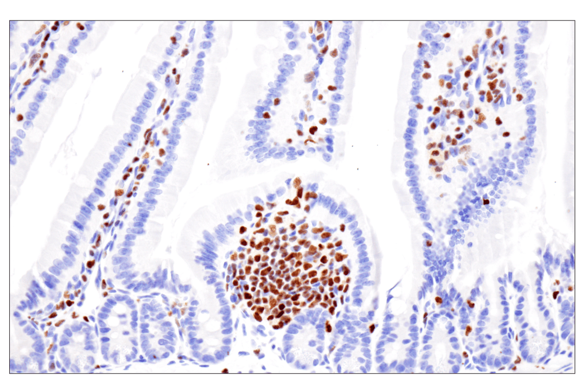 Immunohistochemistry Image 5: Ikaros (D6N9Y) Rabbit Monoclonal Antibody