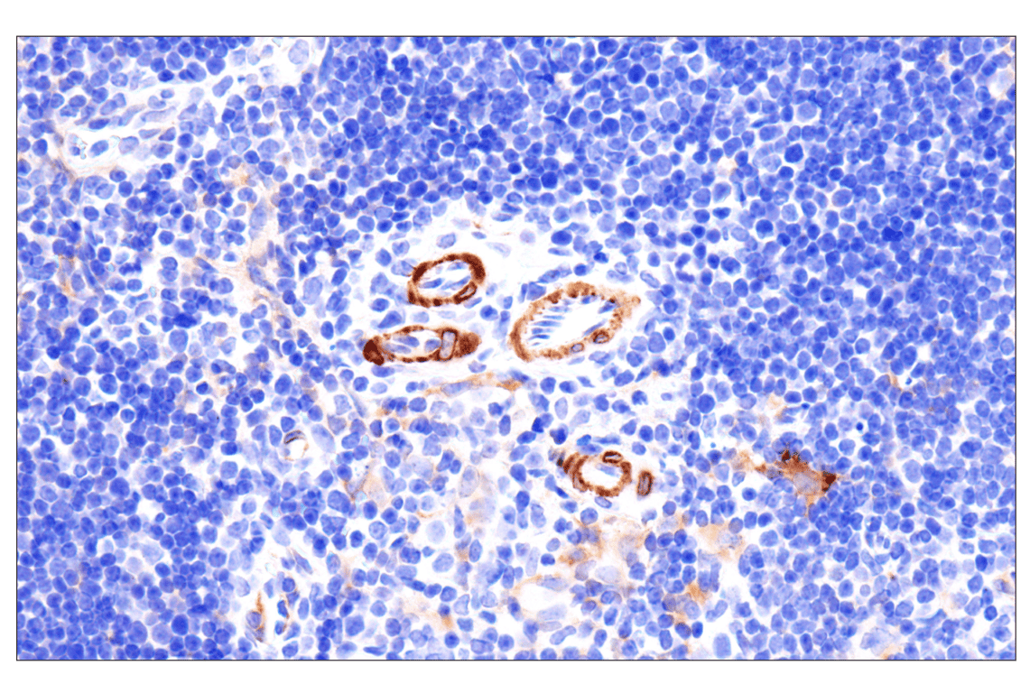 Immunohistochemistry Image 12: MYH11 (E4N8M) Rabbit Monoclonal Antibody (BSA and Azide Free)