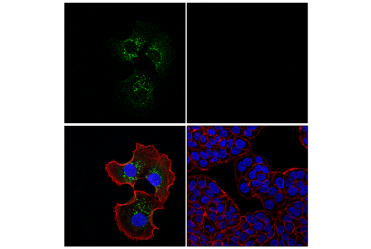 Immunofluorescence Image 1: IGFBP3 (E6C2E) Rabbit Monoclonal Antibody