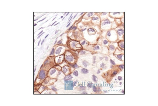 Immunohistochemistry Image 4: Phospho-EGF Receptor (Tyr1173) (53A5) Rabbit Monoclonal Antibody (BSA and Azide Free)